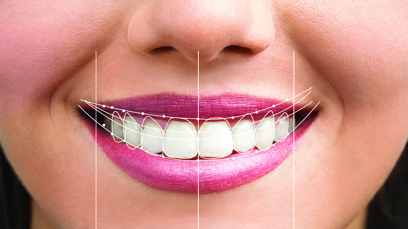 SMILE DESIGN